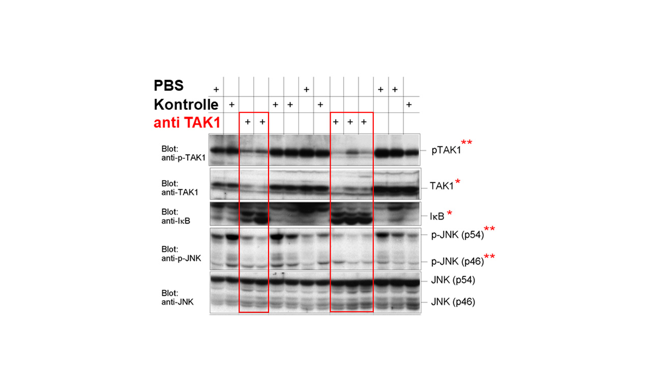 Musculoskeletal System: The Intracellular Protein TAK1